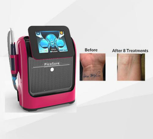 دستگاه لیزر پیکوشور کیوسوئیچ مدل پیکوسکند مدل 2023