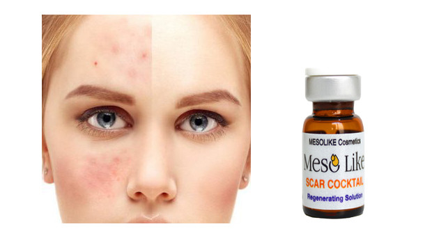 کوکتل اسکار مزولایک SCAR COCKTAIL